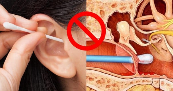 Боль в ушах - что делать, причины и лечение